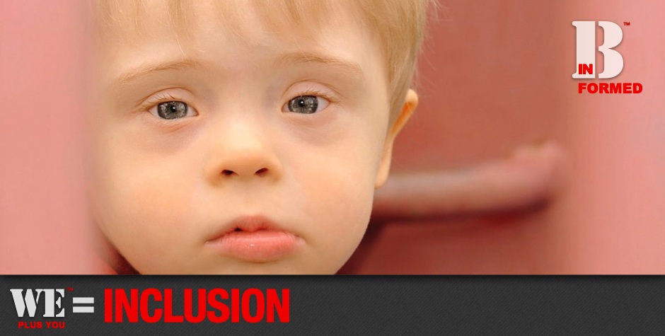 Be Informed_Workforce Development_We Plus You Equals Inclusion_Close up photo of baby boy with big blue eyes and down syndrome looking into camera